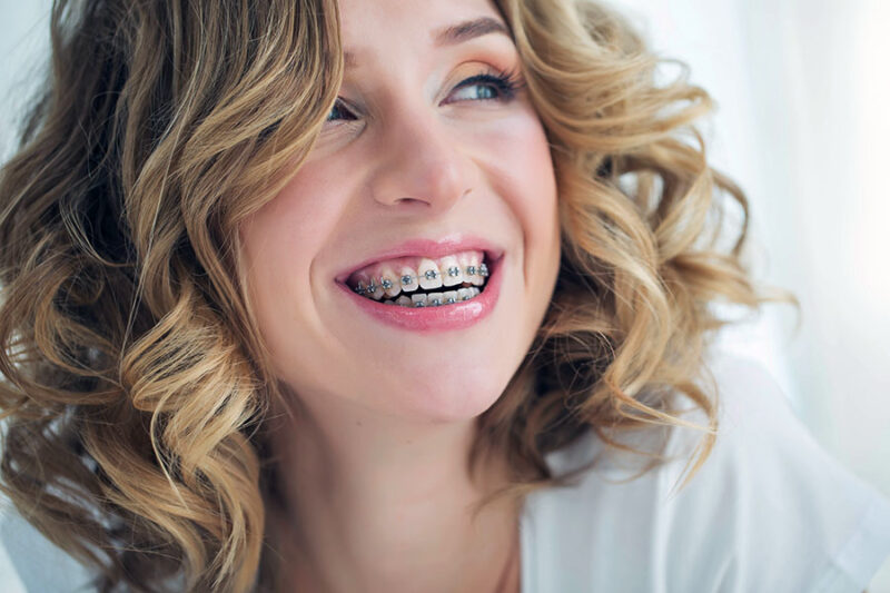 LIMITED ORTHO TREATMENT Orthodontic services by Murray Orthodontics