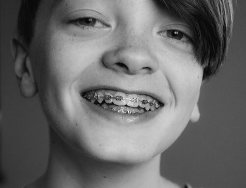 Unlocking the Benefits of Early Orthodontic Care